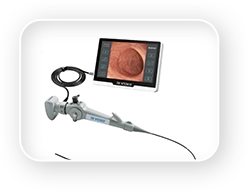 포터블내시경