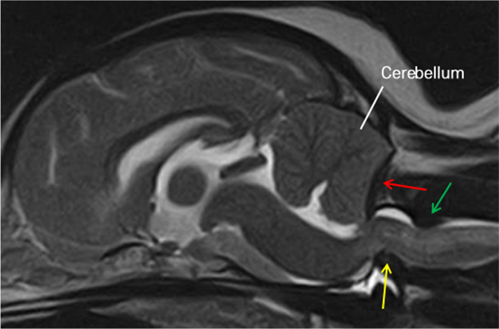 cerebellum