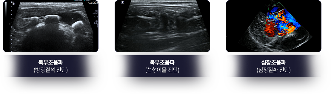 복부초음파(방광결석 진단)-복부초음파(선형이물-진단)-심장초음파(심장질환 진단)
